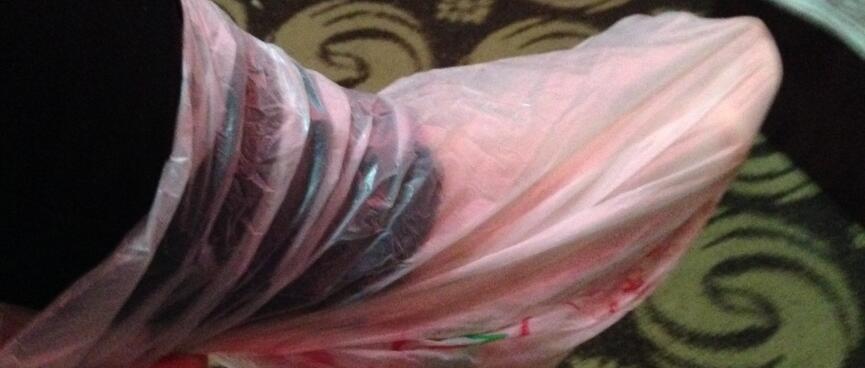 A pink plastic bag covers my foot and ankle.